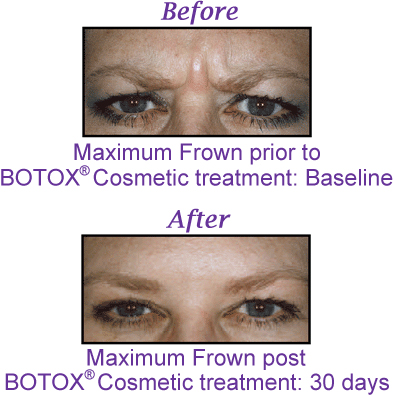 Perfectly You > Non-Invasive Medical Cosmetic Enhancement